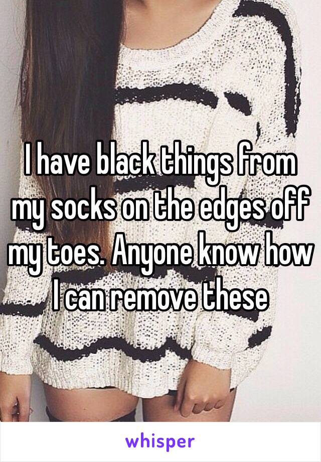 I have black things from my socks on the edges off my toes. Anyone know how I can remove these 