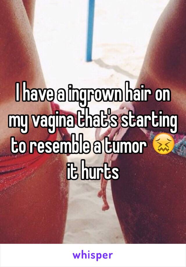 I have a ingrown hair on my vagina that's starting to resemble a tumor 😖 it hurts