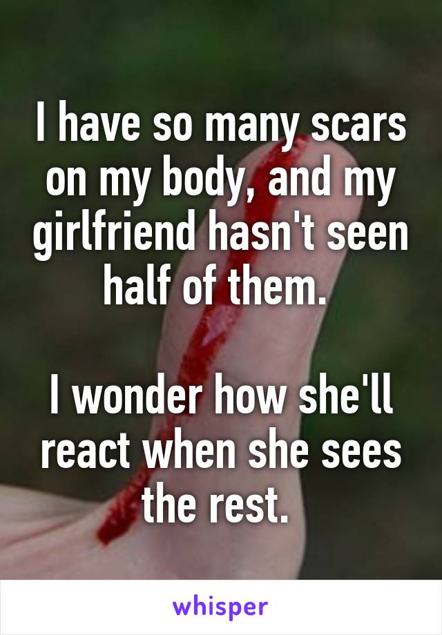 I have so many scars on my body, and my girlfriend hasn't seen half of them. 

I wonder how she'll react when she sees the rest. 