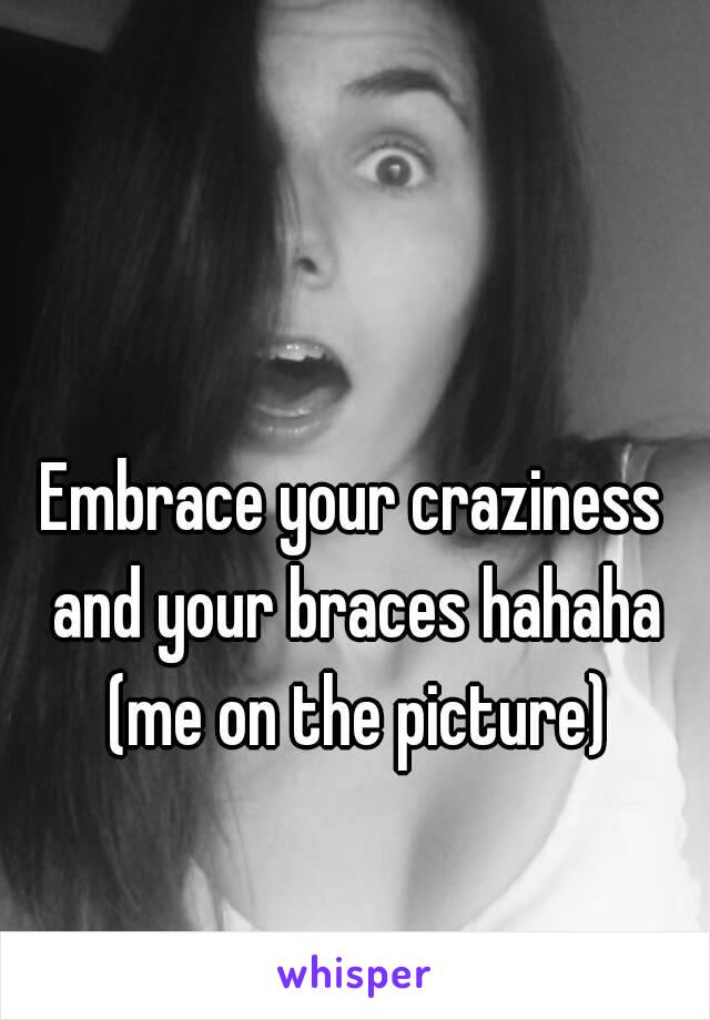 Embrace your craziness and your braces hahaha (me on the picture)