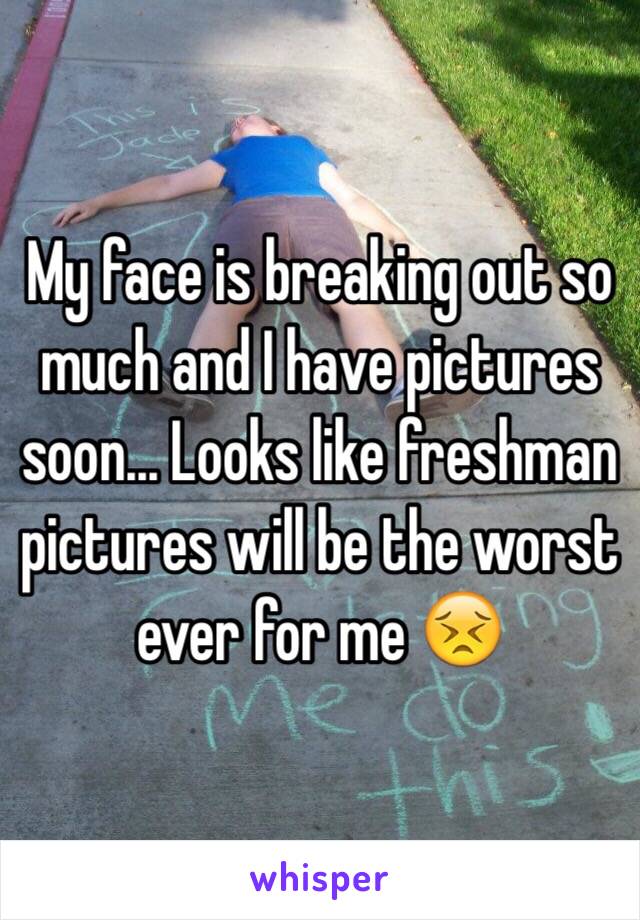 My face is breaking out so much and I have pictures soon... Looks like freshman pictures will be the worst ever for me 😣