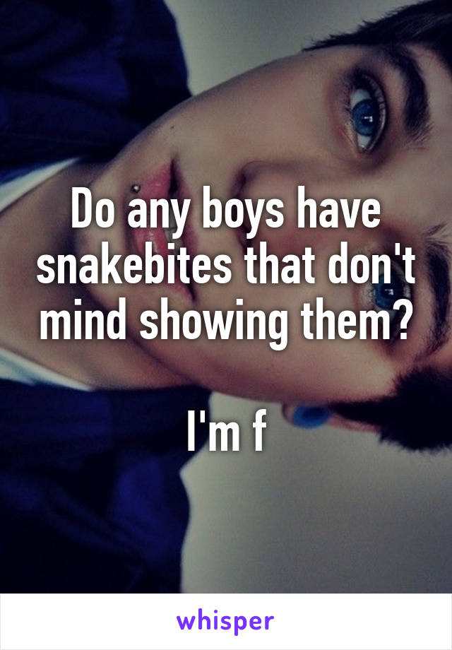 Do any boys have snakebites that don't mind showing them?

I'm f