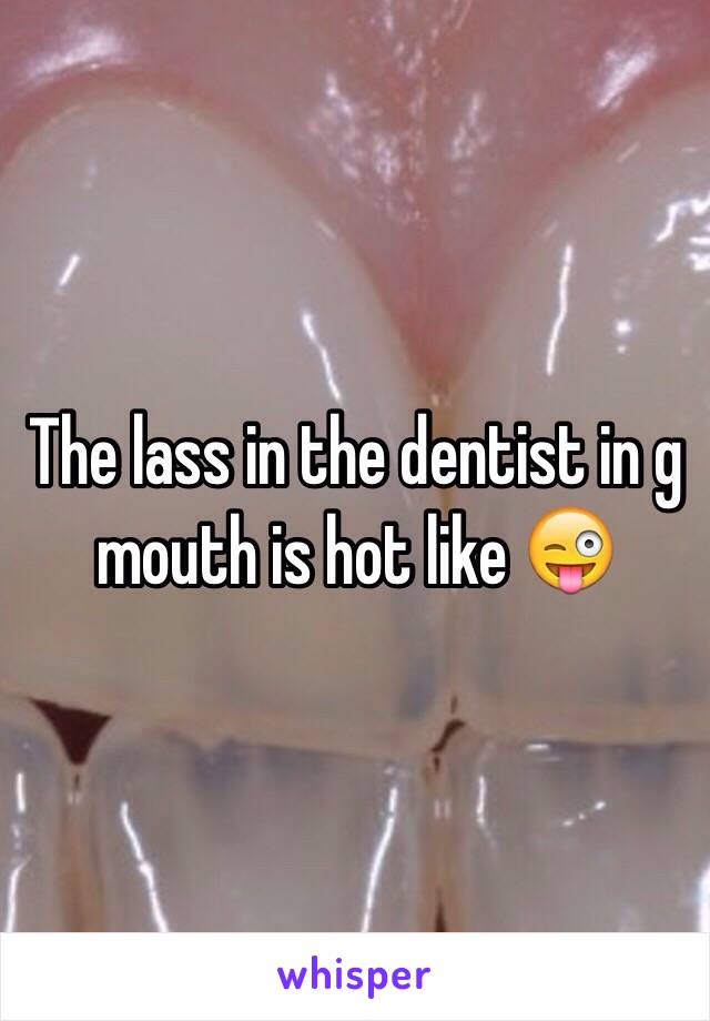The lass in the dentist in g mouth is hot like 😜