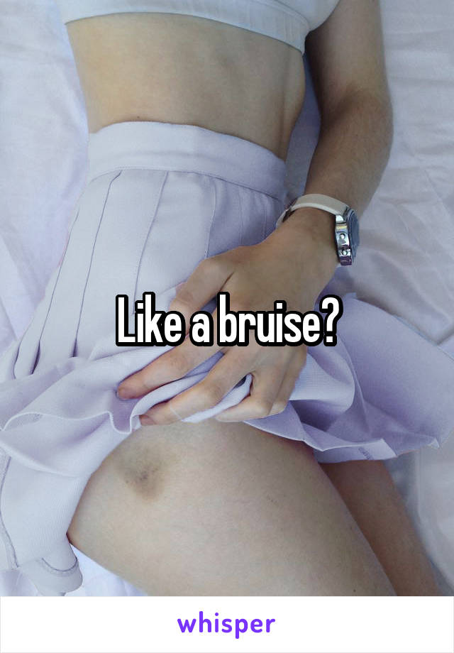 Like a bruise?