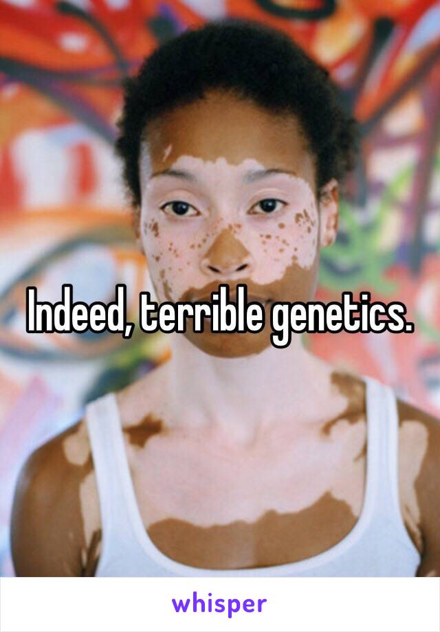 Indeed, terrible genetics. 