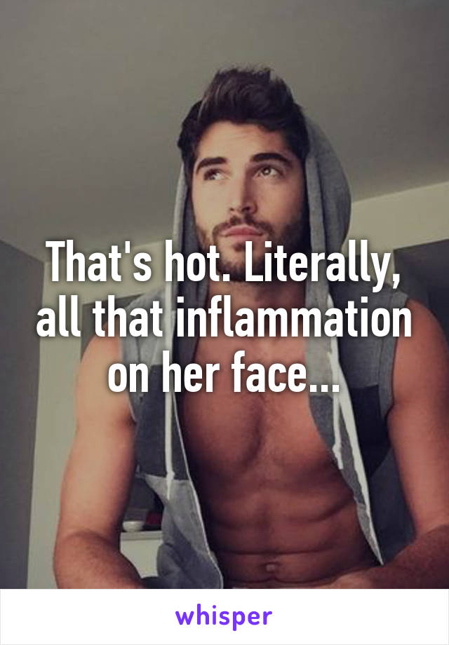 That's hot. Literally, all that inflammation on her face...