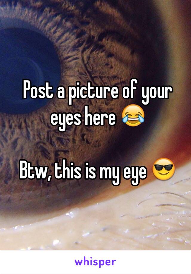 Post a picture of your eyes here 😂

Btw, this is my eye 😎