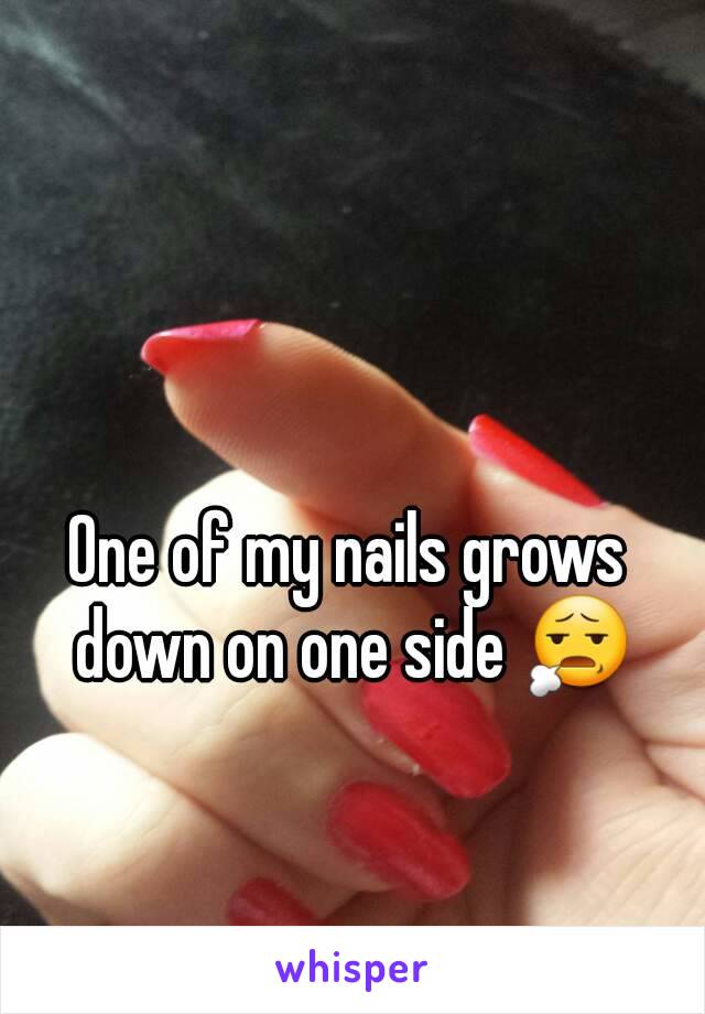 One of my nails grows down on one side 😧