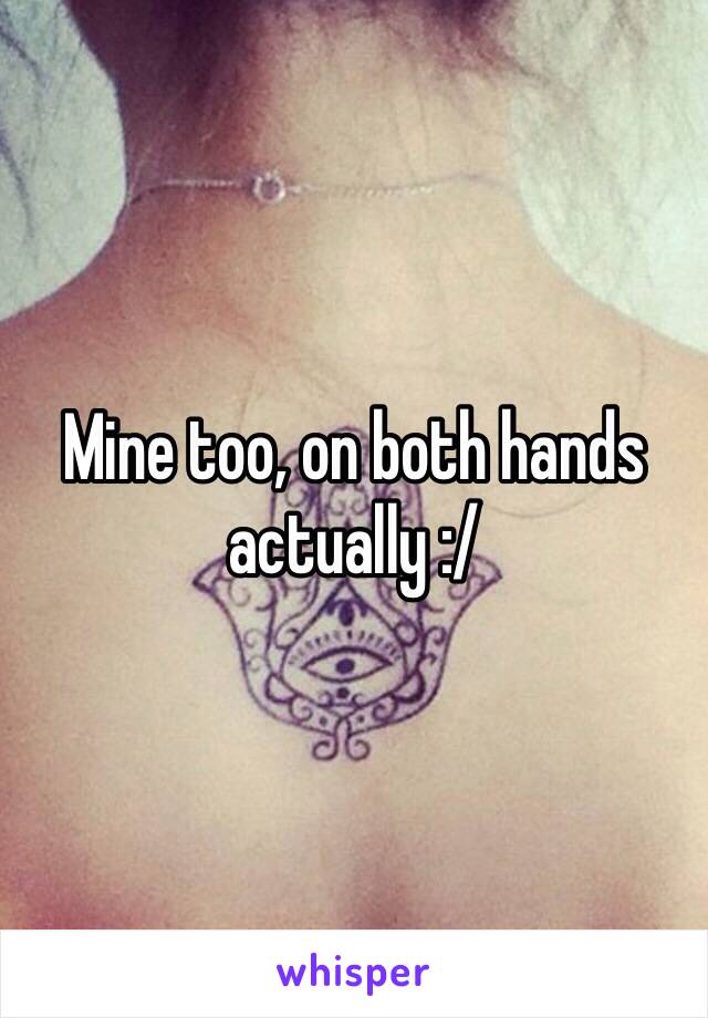 Mine too, on both hands actually :/ 