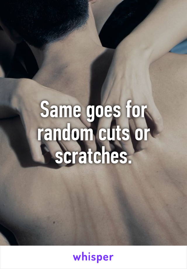 Same goes for random cuts or scratches.