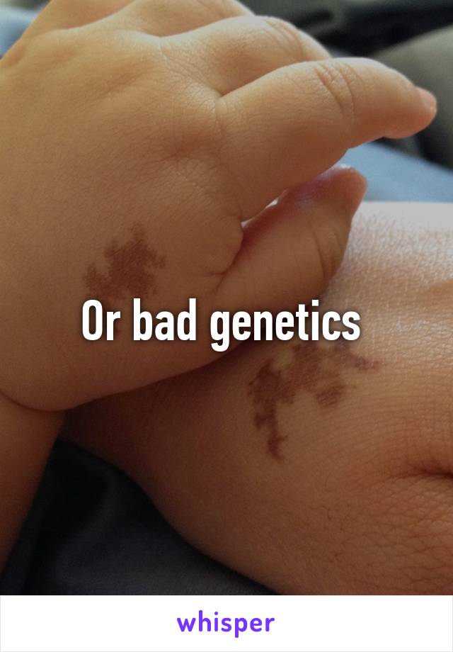 Or bad genetics 