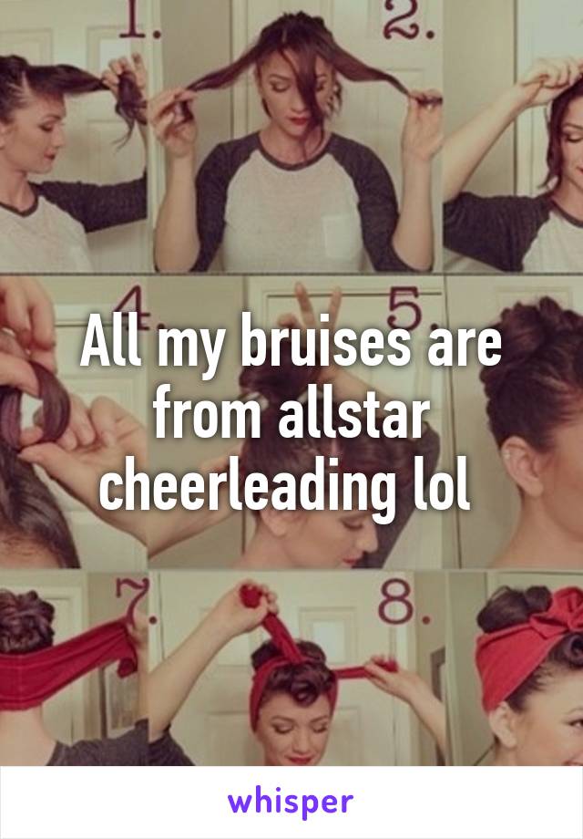 All my bruises are from allstar cheerleading lol 