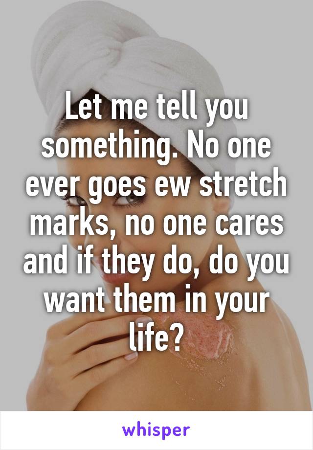 Let me tell you something. No one ever goes ew stretch marks, no one cares and if they do, do you want them in your life?