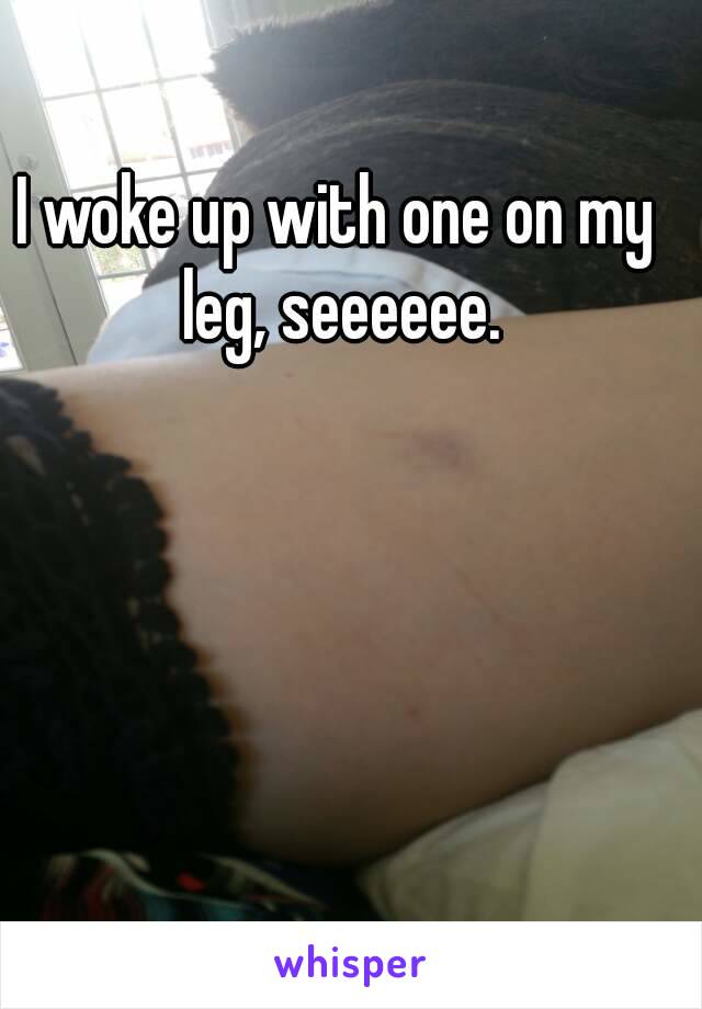 I woke up with one on my leg, seeeeee.