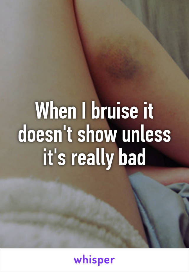 When I bruise it doesn't show unless it's really bad