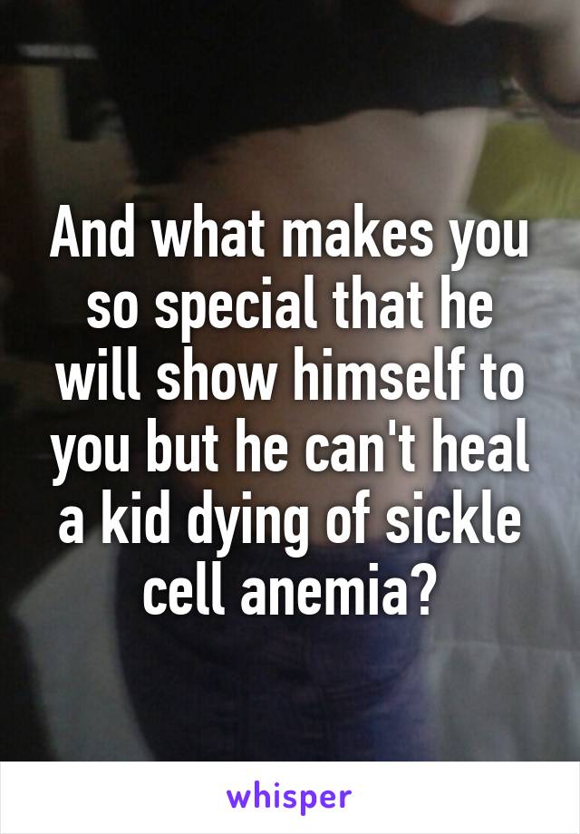 And what makes you so special that he will show himself to you but he can't heal a kid dying of sickle cell anemia?