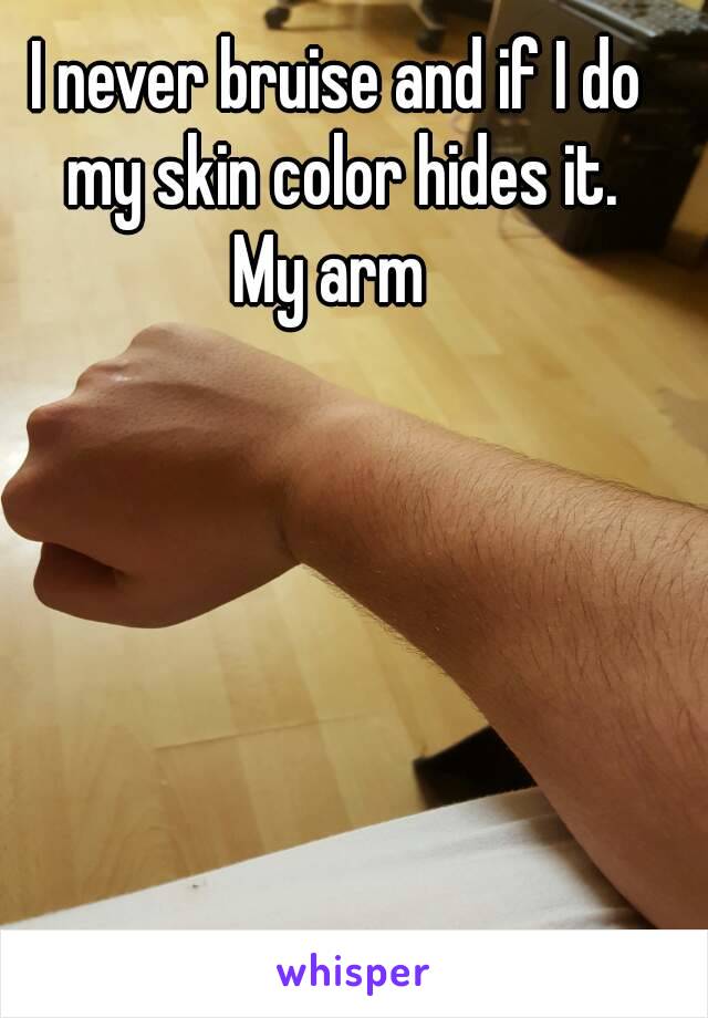 I never bruise and if I do my skin color hides it.
My arm 