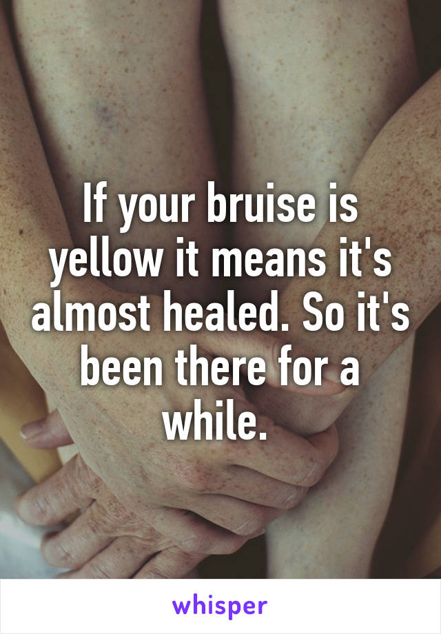 If your bruise is yellow it means it's almost healed. So it's been there for a while. 