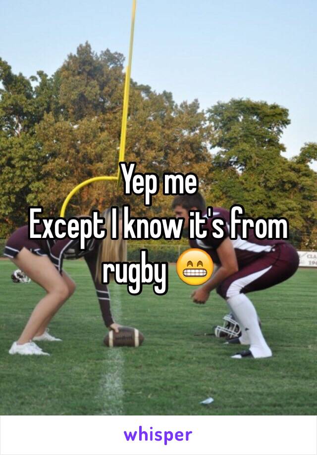 Yep me 
Except I know it's from rugby 😁