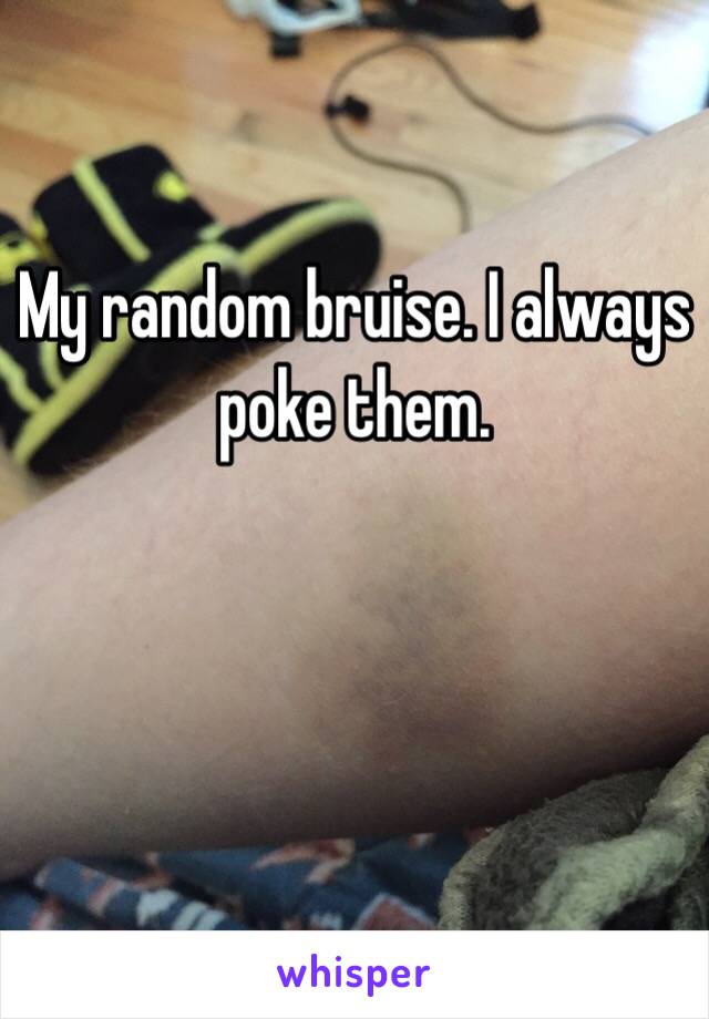 My random bruise. I always poke them. 