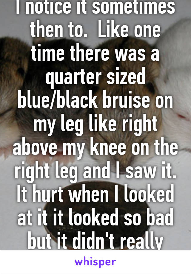 I notice it sometimes then to.  Like one time there was a quarter sized blue/black bruise on my leg like right above my knee on the right leg and I saw it. It hurt when I looked at it it looked so bad but it didn't really hurt 