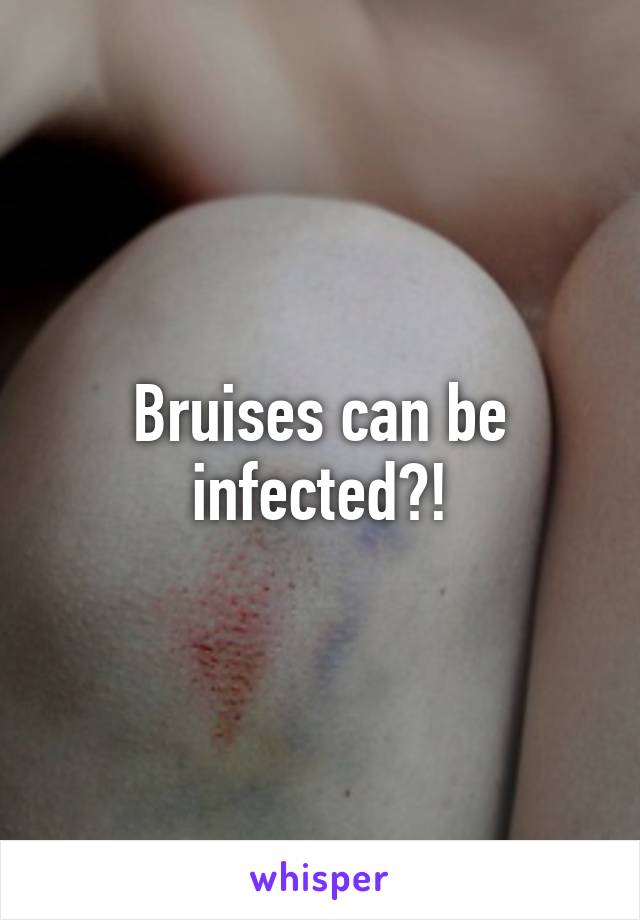 Bruises can be infected?!