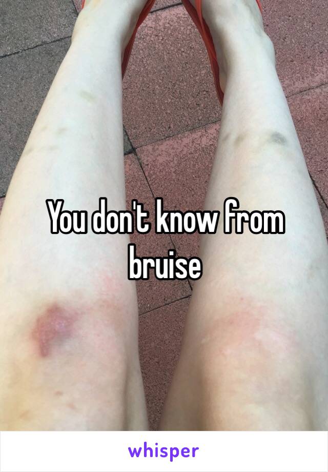 You don't know from bruise