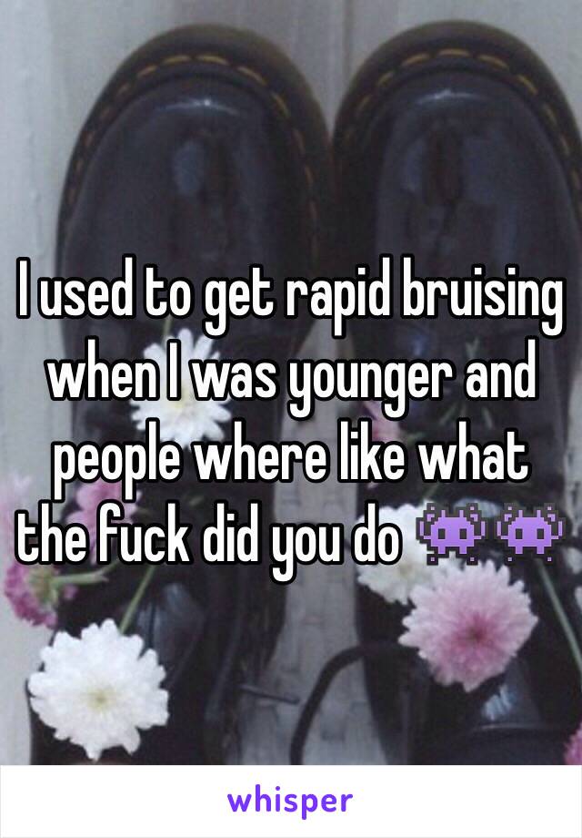 I used to get rapid bruising when I was younger and people where like what the fuck did you do 👾👾