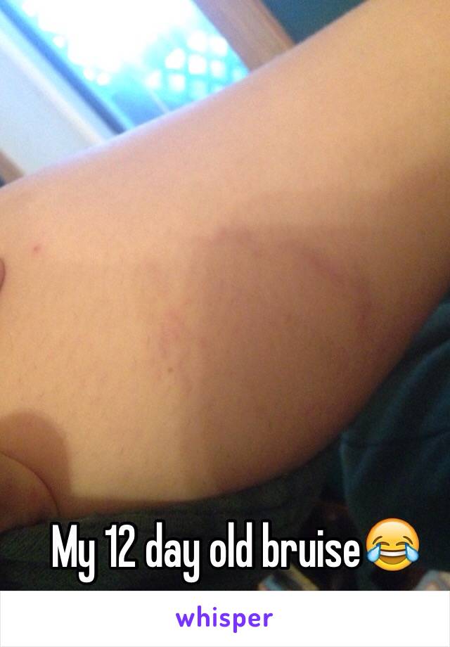 My 12 day old bruise😂