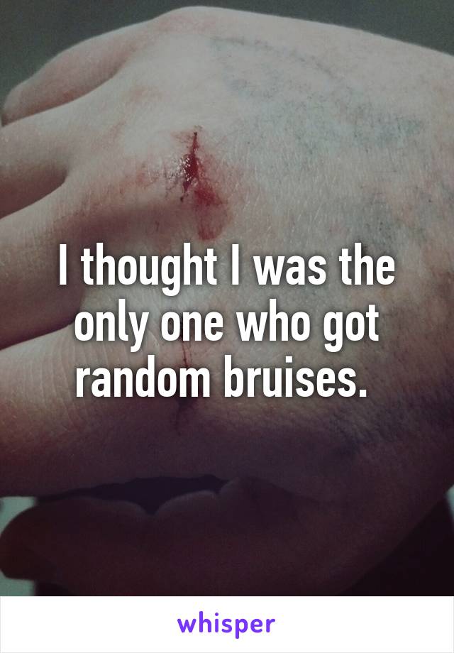 I thought I was the only one who got random bruises. 