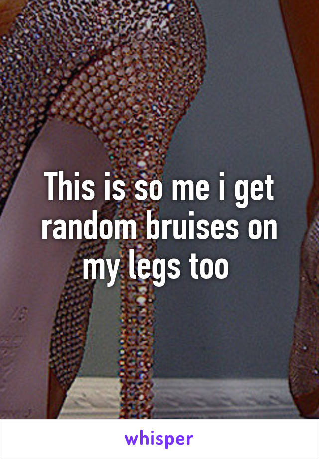 This is so me i get random bruises on my legs too 