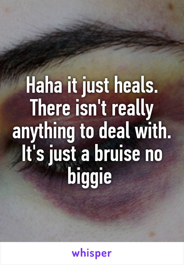 Haha it just heals. There isn't really anything to deal with. It's just a bruise no biggie 