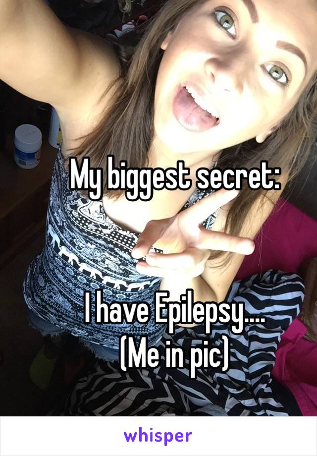 My biggest secret: 


I have Epilepsy.... 
(Me in pic)