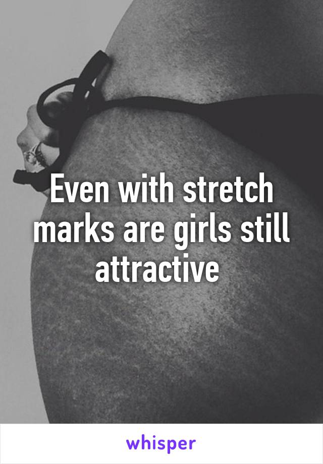 Even with stretch marks are girls still attractive 