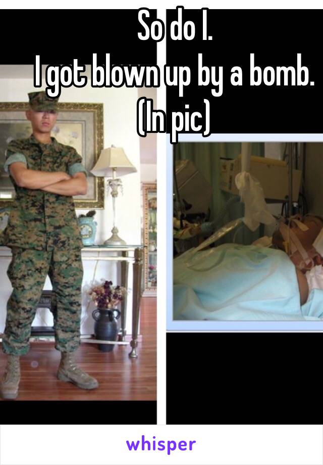 So do I.
I got blown up by a bomb.
(In pic)