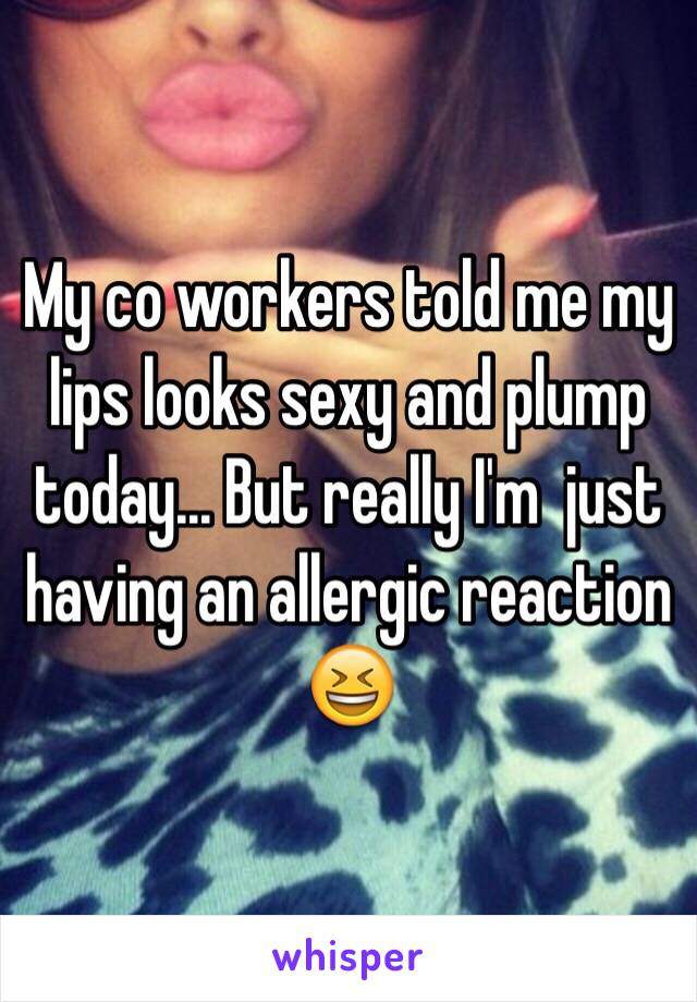 My co workers told me my lips looks sexy and plump today... But really I'm  just having an allergic reaction 😆