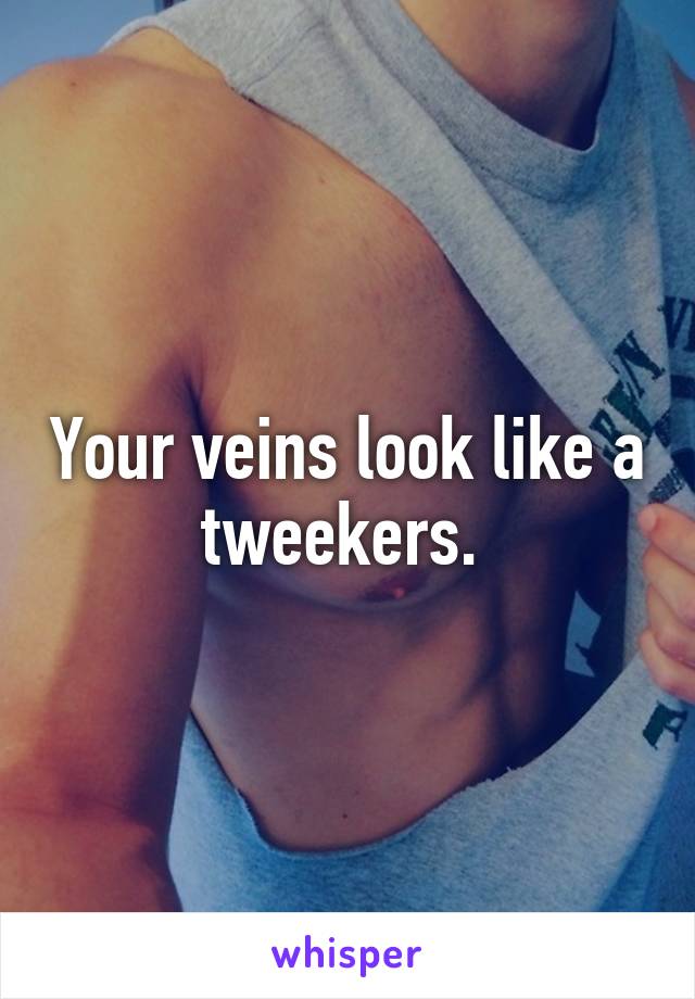 Your veins look like a tweekers. 