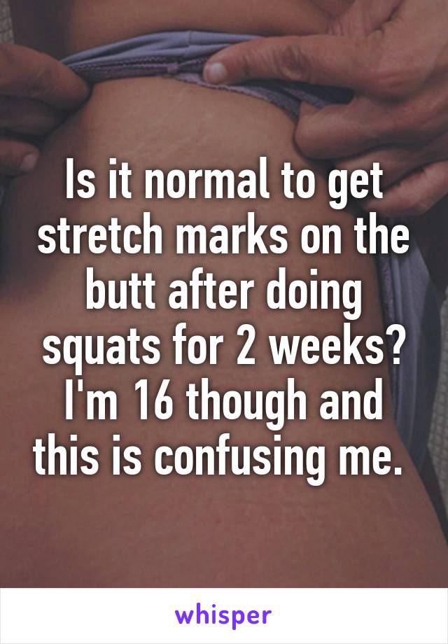 Is it normal to get stretch marks on the butt after doing squats for 2 weeks? I'm 16 though and this is confusing me. 