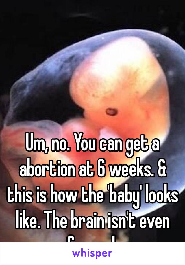 Um, no. You can get a abortion at 6 weeks. & this is how the 'baby' looks like. The brain isn't even formed. 