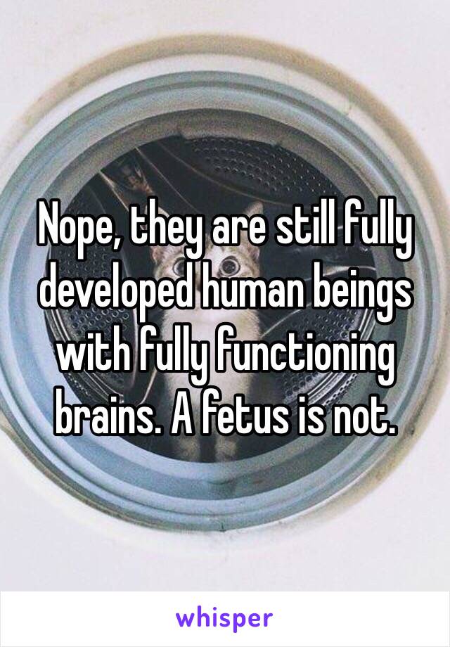 Nope, they are still fully developed human beings with fully functioning brains. A fetus is not. 