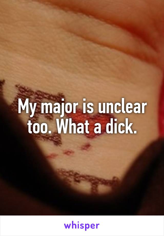 My major is unclear too. What a dick.