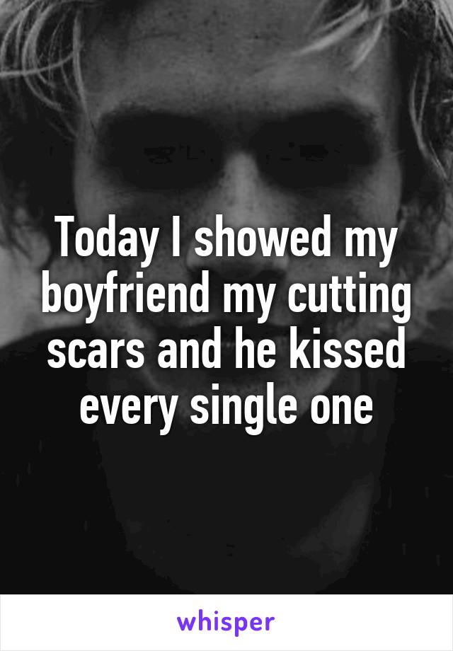 Today I showed my boyfriend my cutting scars and he kissed every single one