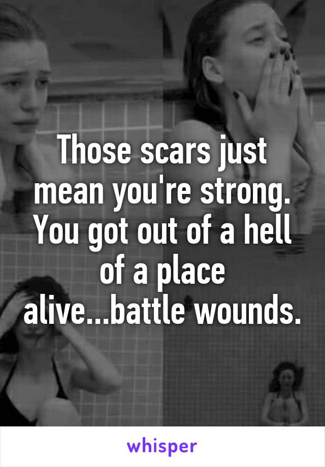 Those scars just mean you're strong. You got out of a hell of a place alive...battle wounds.