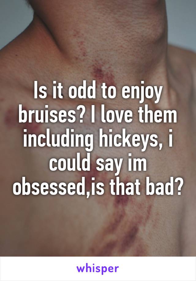 Is it odd to enjoy bruises? I love them including hickeys, i could say im obsessed,is that bad?