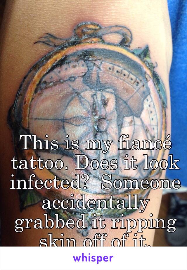 This is my fiancé tattoo. Does it look infected?  Someone accidentally grabbed it ripping skin off of it.