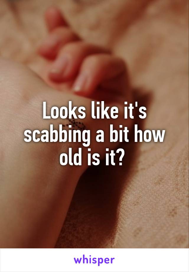 Looks like it's scabbing a bit how old is it? 