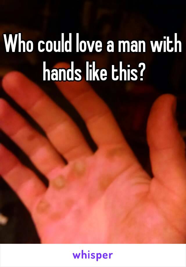 Who could love a man with hands like this?