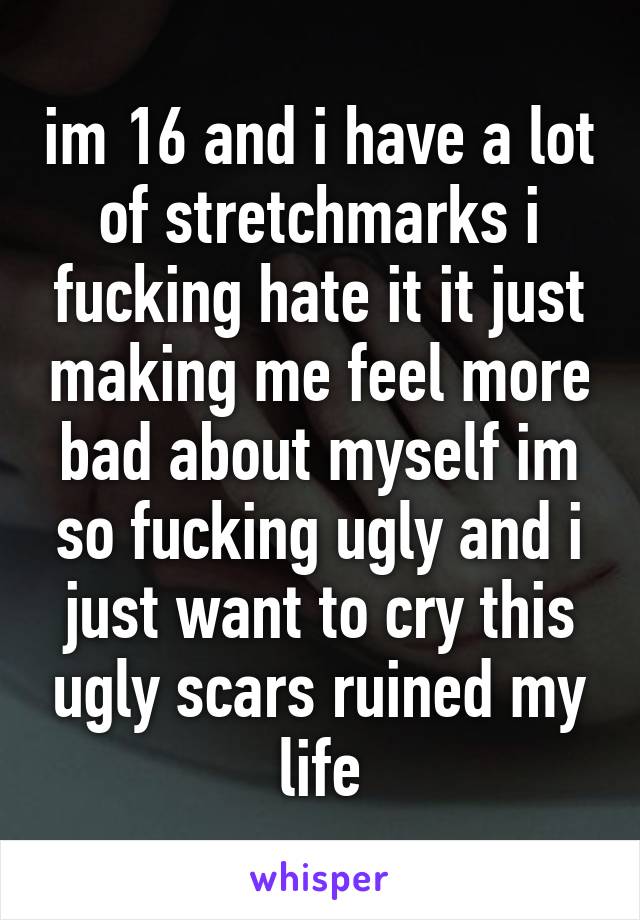 im 16 and i have a lot of stretchmarks i fucking hate it it just making me feel more bad about myself im so fucking ugly and i just want to cry this ugly scars ruined my life