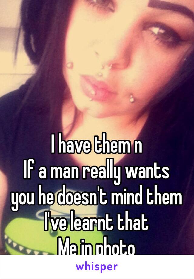 I have them n 
If a man really wants 
you he doesn't mind them 
I've learnt that
Me in photo