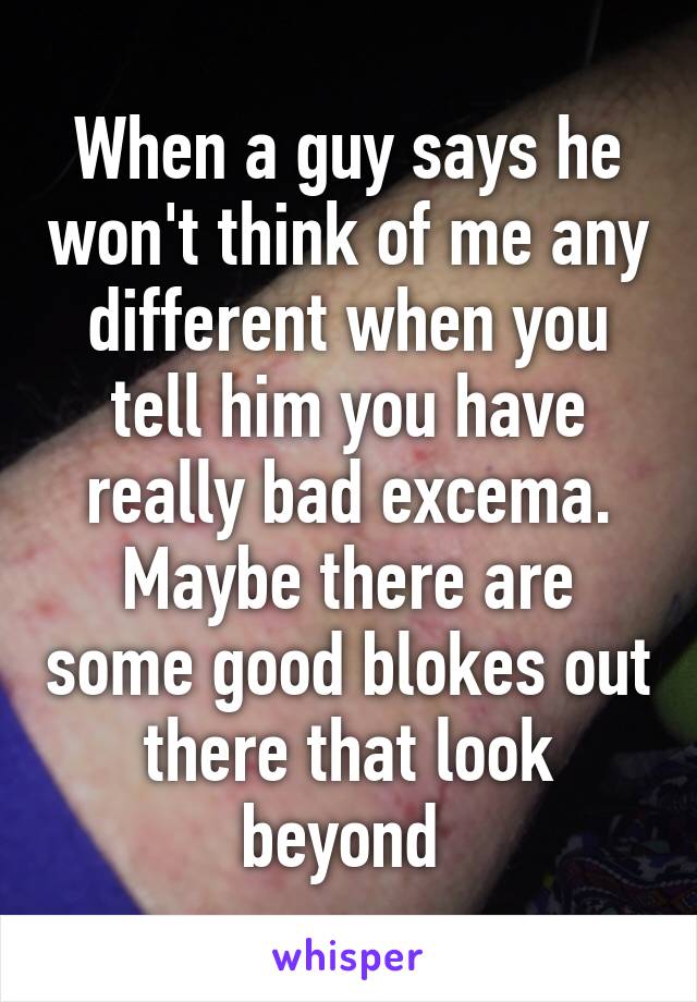 When a guy says he won't think of me any different when you tell him you have really bad excema. Maybe there are some good blokes out there that look beyond 